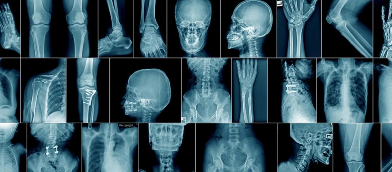 Το ήξερες; - Πόσα κόκαλα έχει ο ανθρώπινος σκελετός